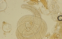 Trichinella, il parassita perfetto